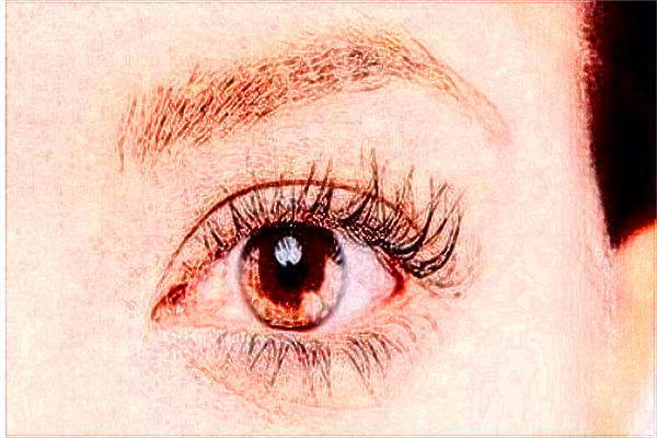 北大醫(yī)院割雙眼皮怎樣_哪個(gè)醫(yī)生做得好