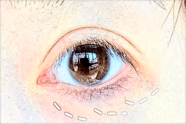 2024南昌大學(xué)第一附屬醫(yī)院做價(jià)格?做要多久