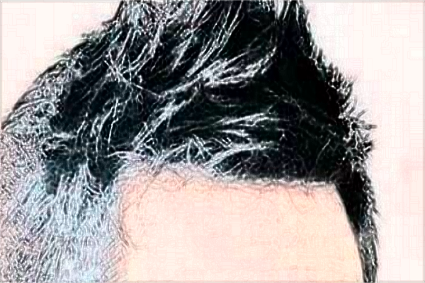 南昌大學(xué)第一附屬醫(yī)院種植頭發(fā)怎么樣?2024植發(fā)價(jià)格