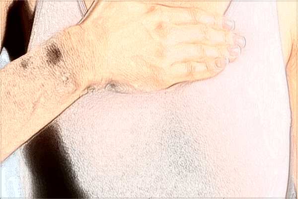 2024河北省人民醫(yī)院整形科怎么樣_附整形科醫(yī)生名單推薦