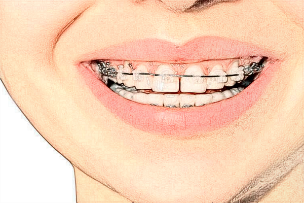 無(wú)錫市第二人民醫(yī)院口腔科牙齒矯正好的醫(yī)生有哪些