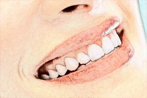 2024江蘇省口腔醫(yī)院種植牙價(jià)格多少_醫(yī)生推薦