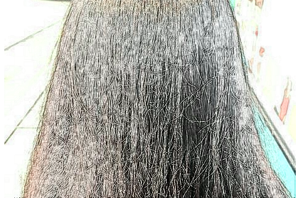 溫州醫(yī)學(xué)院附屬第一醫(yī)院種植頭發(fā)做的好嗎_哪位醫(yī)生做的好