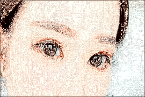 2024溫州醫(yī)學(xué)院附屬第一醫(yī)院做眼袋價(jià)目表(價(jià)格表)怎么樣