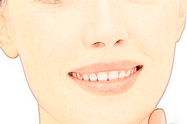 溫州醫(yī)學院附屬第一醫(yī)院祛斑怎么樣_大概需要多少錢