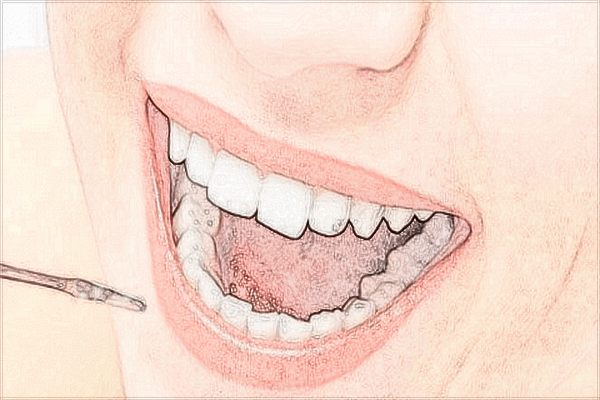 2024無錫市第二人民醫(yī)院口腔科哪個(gè)醫(yī)生好_價(jià)格貴不貴