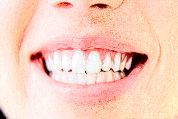 2024北京大學(xué)第一醫(yī)院口腔科洗牙怎么樣_技術(shù)好不好