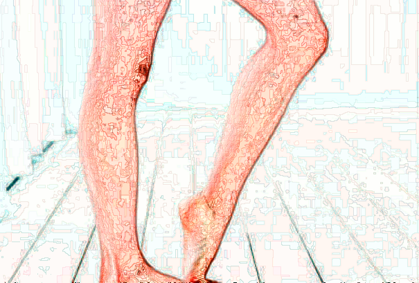 北京大學(xué)第一醫(yī)院洗紋身價目表(價格表)怎么樣