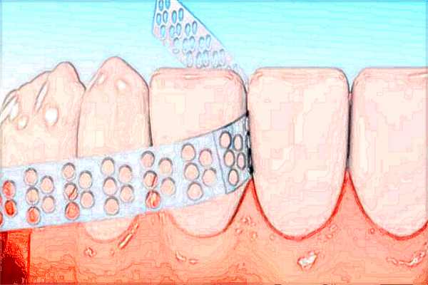 淮北市人民醫(yī)院牙科醫(yī)生名單介紹【附案例】
