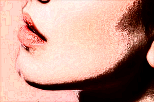 六安市人民醫(yī)院激光去除一顆老年斑需要多少錢_案例