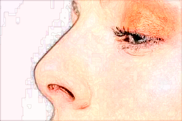 北京大學第一醫(yī)院整形科醫(yī)生名單簡介+價格