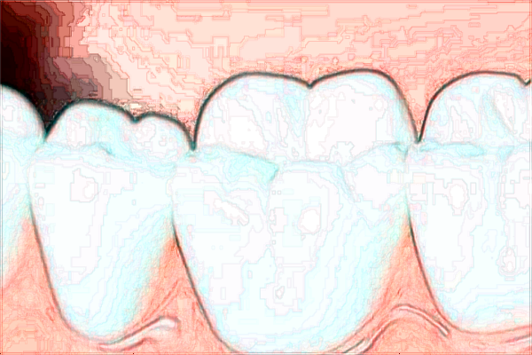 北京大學(xué)第一醫(yī)院口腔科那個(gè)醫(yī)生好+案例分享