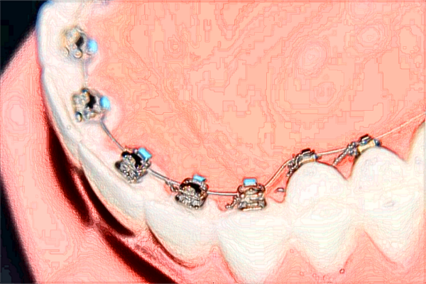 北京大學(xué)第一醫(yī)院口腔科那個(gè)醫(yī)生好+案例分享