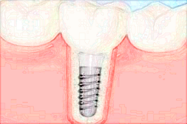 北京大學第一醫(yī)院口腔科王曉敏經(jīng)驗怎么樣_技術(shù)好不好