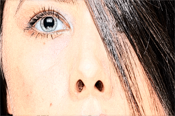 2024南昌大學第二附屬醫(yī)院祛疤價格是多少?祛疤手術能完全祛疤嗎