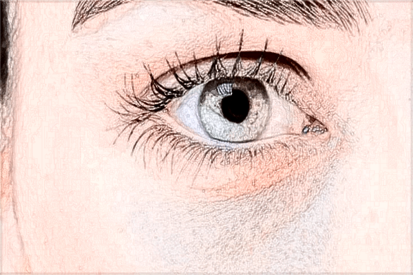 南昌大學(xué)第二附屬醫(yī)院激光近視大概多少錢?激光近視后遺癥