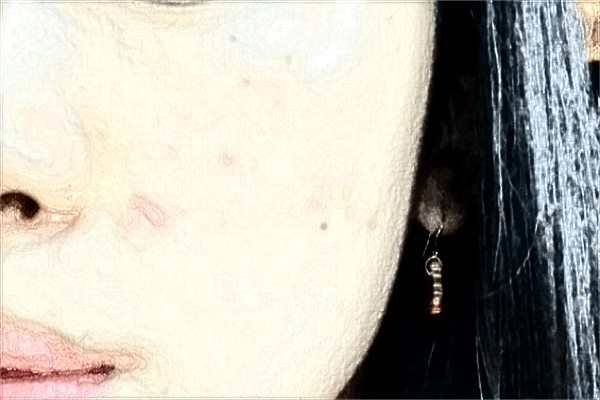 南昌大學第二附屬醫(yī)院祛斑怎么樣?2024激光祛斑需要多少錢