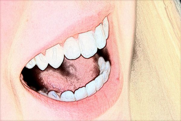 寧波李惠利醫(yī)院正畸做的好嗎_哪位醫(yī)生做的好