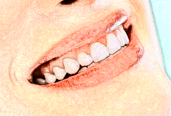 2024江蘇省口腔醫(yī)院地包天矯正做的怎么樣_哪位醫(yī)生做的不錯