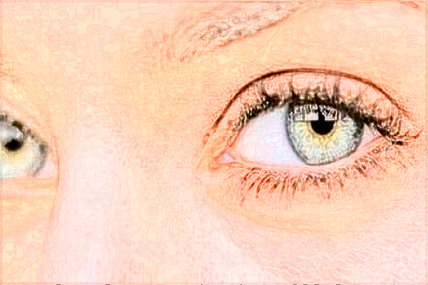 2024無錫市第二人民醫(yī)院激光矯正靠譜嗎_哪位醫(yī)生技術比較好