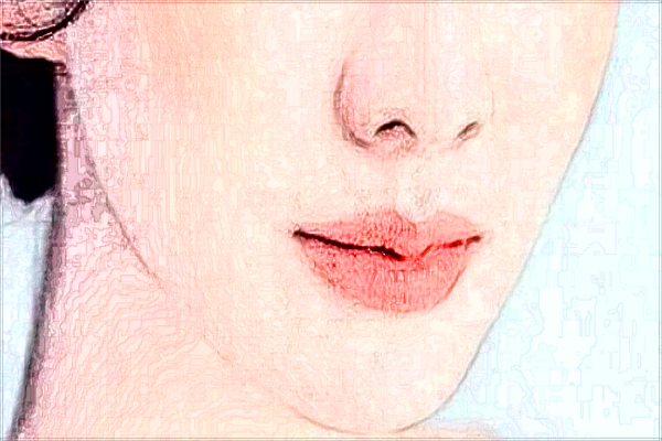 哈爾濱市第一醫(yī)院祛斑做的好不好_案例+價(jià)格