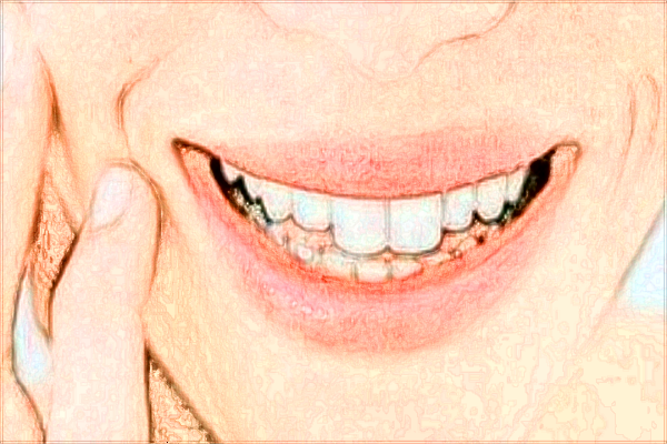 無錫市第二人民醫(yī)院種植牙價格多少_醫(yī)生技術怎么樣