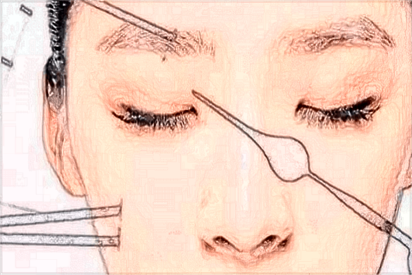 贛州市人民醫(yī)院激光祛斑掛哪個(gè)門診?激光祛斑多久能恢復(fù)