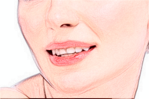 無錫市第二人民醫(yī)院激光脫毛做的好嗎_醫(yī)生推薦