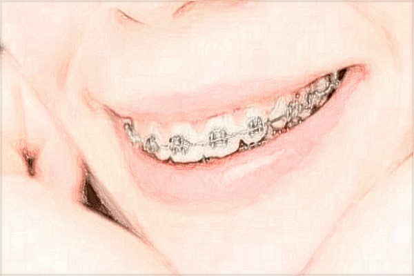 2024河北醫(yī)科大學(xué)口腔醫(yī)院是三甲醫(yī)院嗎?醫(yī)生名單+價格