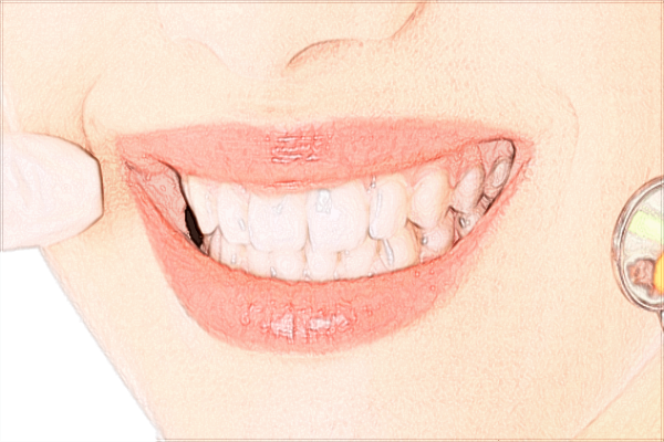 2024河北醫(yī)科大學(xué)口腔醫(yī)院是三甲醫(yī)院嗎?醫(yī)生名單+價格