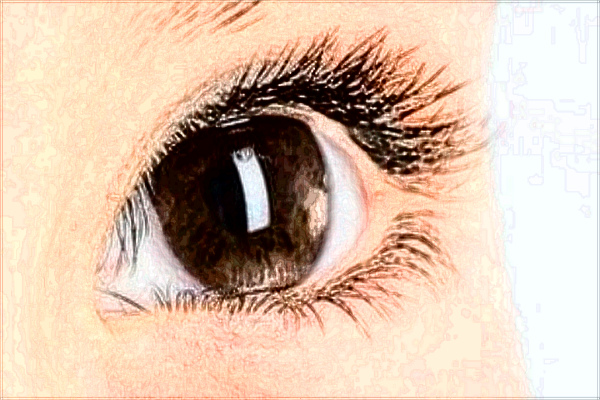 2024保定市第一中心醫(yī)院去眼袋多少錢_案例+價(jià)格分享