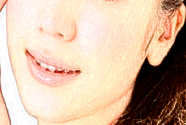 保定市第一中心醫(yī)院激光祛斑價(jià)目表(價(jià)格表)怎么樣