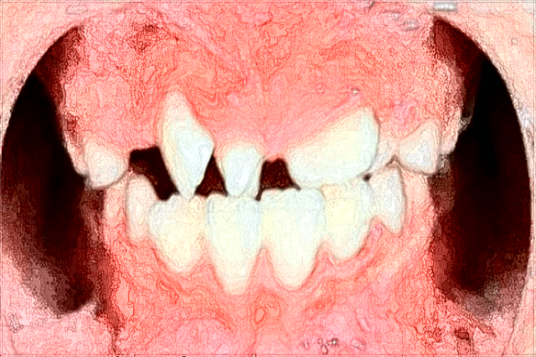 昆明中醫(yī)院牙科怎么樣?2024牙科收費(fèi)價(jià)格?