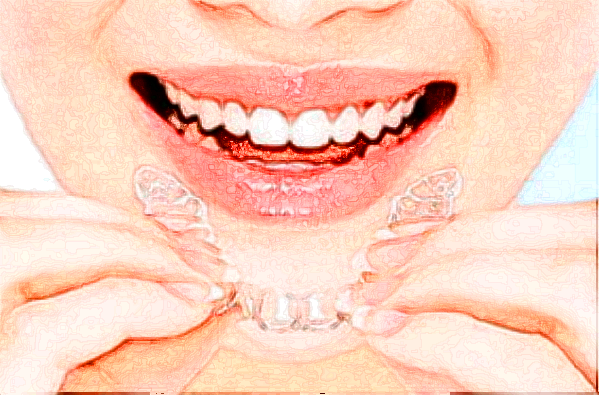 河北醫(yī)科大學(xué)口腔醫(yī)院牙齒貼面價(jià)目表(價(jià)格表)怎么樣