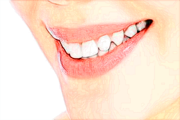 南充市中心醫(yī)院種植牙做的好嗎_案例價(jià)格分享