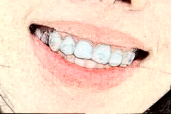 2024常州市第一人民醫(yī)院種植牙齒價(jià)目表(價(jià)格表)怎么樣