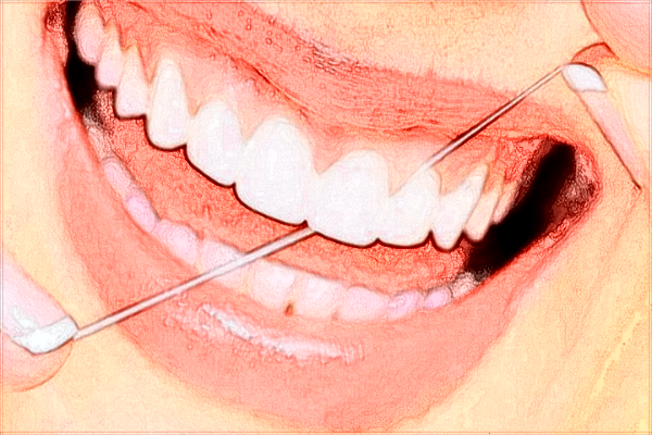 2024昆明市第一人民醫(yī)院牙科收費?種植牙收費貴嗎?