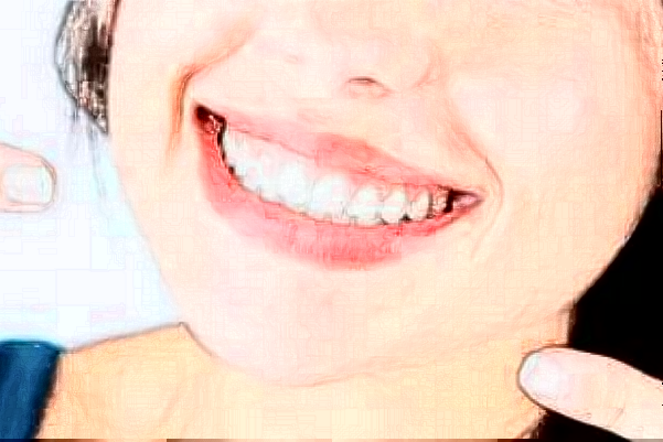 四川大學(xué)華西口腔醫(yī)院激光美容做的怎么樣_附醫(yī)生推薦