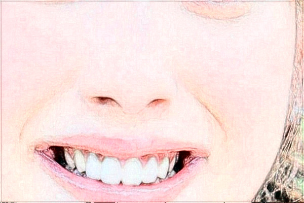 四川大學(xué)華西口腔醫(yī)院牙齒正畸好不好_哪個(gè)醫(yī)生做的不錯(cuò)