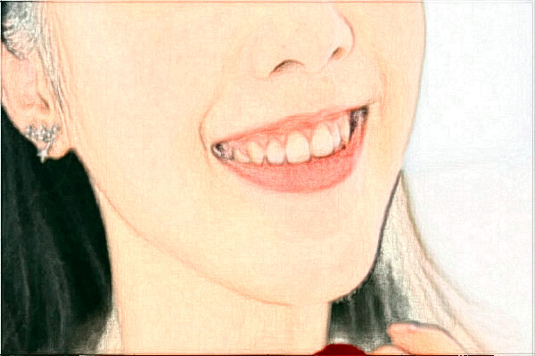 蘇州大學(xué)附屬第二醫(yī)院牙齒根管怎么樣_醫(yī)生技術(shù)好不好