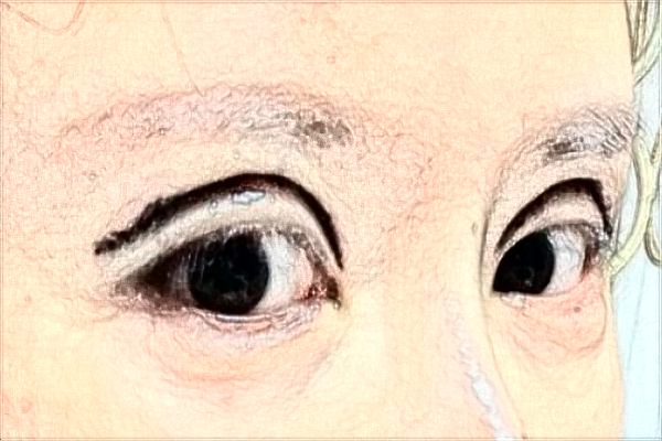 上海切開雙眼皮做的好不好_哪家醫(yī)院做的比較好