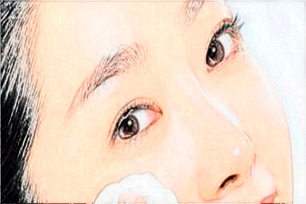 金華市中心醫(yī)院激光祛胎記做的好嗎_案例+價(jià)格