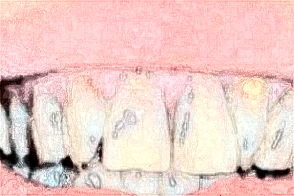 2024南昌大學(xué)第一附屬醫(yī)院牙齒矯正價格?牙科比較好的醫(yī)師