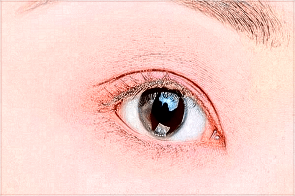 南昌大學(xué)第一附屬醫(yī)院近視激光手術(shù)怎么樣?近視激光手術(shù)價(jià)格