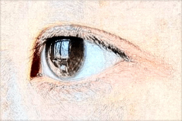 南昌大學(xué)第一附屬醫(yī)院近視眼手術(shù)好嗎?2024近視眼手術(shù)費用