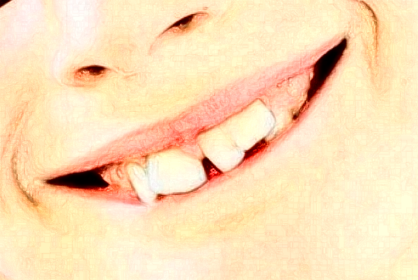 2024四川大學(xué)華西口腔醫(yī)院正頜怎么樣_醫(yī)生技術(shù)好不好