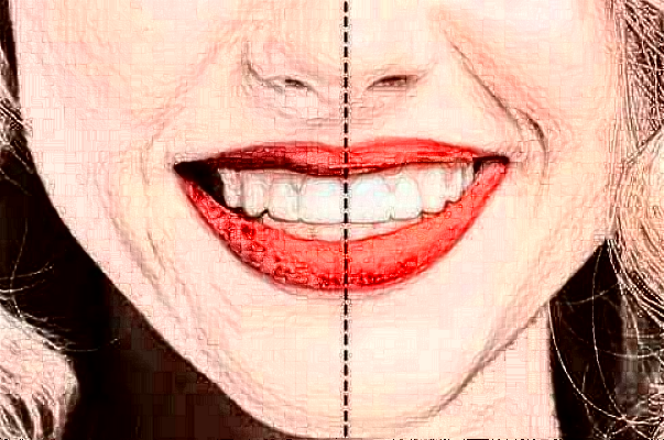 2024四川大學(xué)華西口腔醫(yī)院洗牙怎么樣_案例+價(jià)格展示