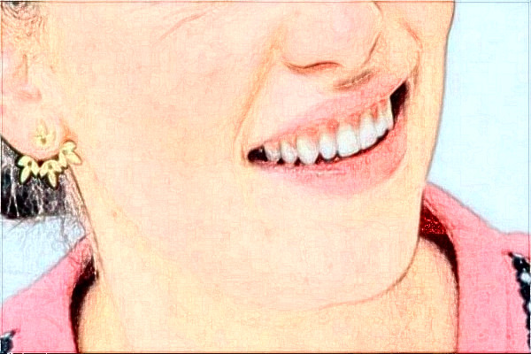 金華市中心醫(yī)院整牙做的好嗎_案例+價(jià)格