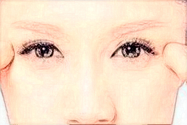 哈爾濱醫(yī)科大學(xué)附屬第一醫(yī)院光子嫩膚怎么樣【光子嫩膚案例】