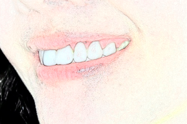 蘇州大學(xué)附屬第二醫(yī)院全瓷牙做的怎么樣_哪個醫(yī)生做的比較好